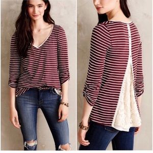 Small Stripe & Lace Button Back T